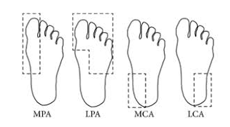 Diabetic Foot Ulceration | Machine Learning | Image Processing